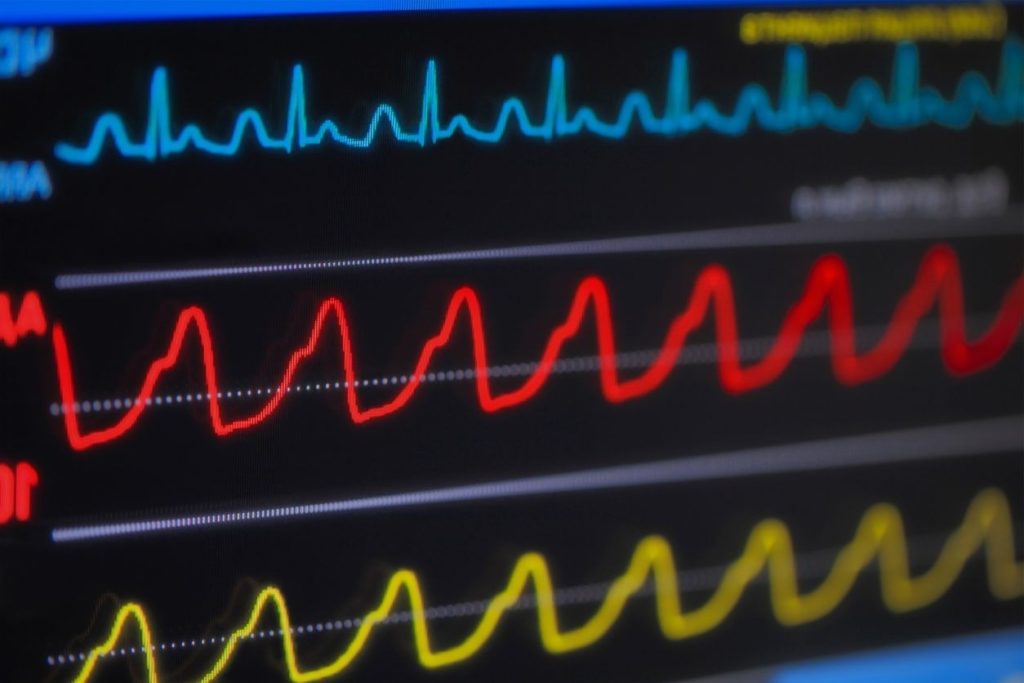 Shortness of breath and rapid heartbeat